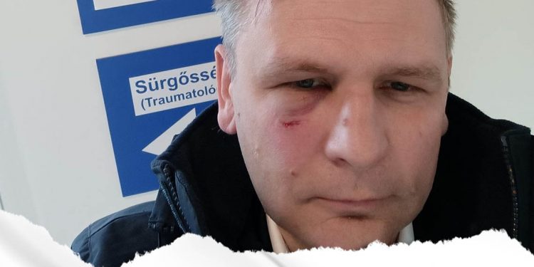 Baloldali agresszió, így vezetik le az ellenzéki politikusok a frusztrációjukat